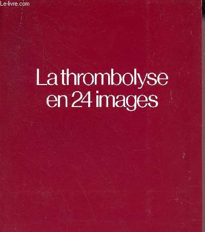 La thrombolyse en 24 images