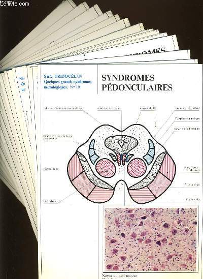 LOT DE 16 fiches de la srie Tridoclan : syndromes pdonculaires, syndromes de l'artre sylvienne, syndrome polyradiculo-nvritique, les syndromes rolandiques, les syndromes de la crbrale antrieure, syndrome parital, syndrome frontal, syndrome mnin