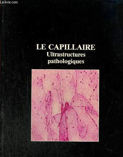 Documentation scientifique des Laboratoires Beytout, n3 : Le Capillaire - Ultrastructures pathologiques