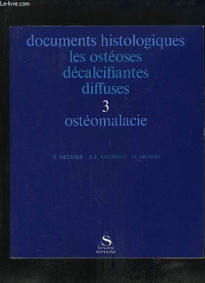LES OSTEOSES DECALCIFIANTES DIFFUSES. 3: OSTEOMALACIE.