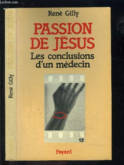 PASSION DE JESUS- LES CONCLUSIONS D UN MEDECIN