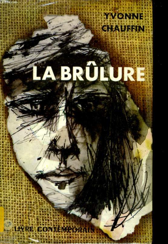 LA BRULURE