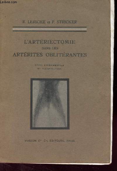 L'ARTERIECTOMIE dans LES ARTERITES OBLITERANTES