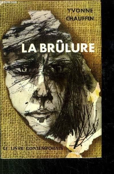 LA BRULURE