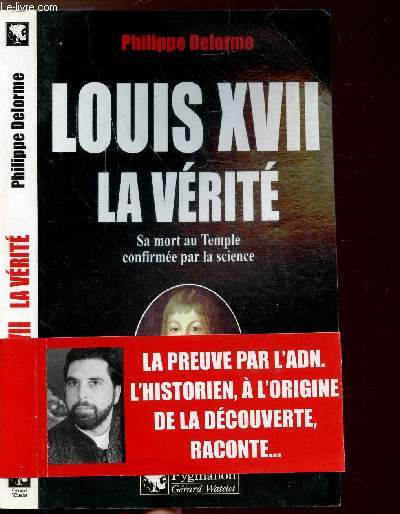 LOUIS XVII LA VERITE - SA MORT AU TEMPLE CONFIRMEE PAR LA SCIENCE