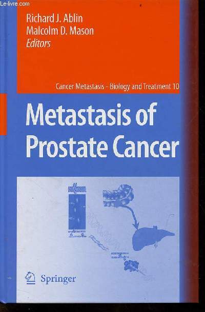 Metastasis of prostate cancer - Cancer Metastasis biology and treatment volume 10.