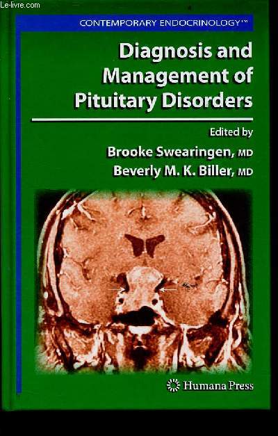 Diagnosis and Management of Pituitary Disorders - Contemporary endocrinology.