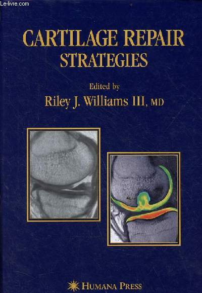 Cartilage repair strategies.