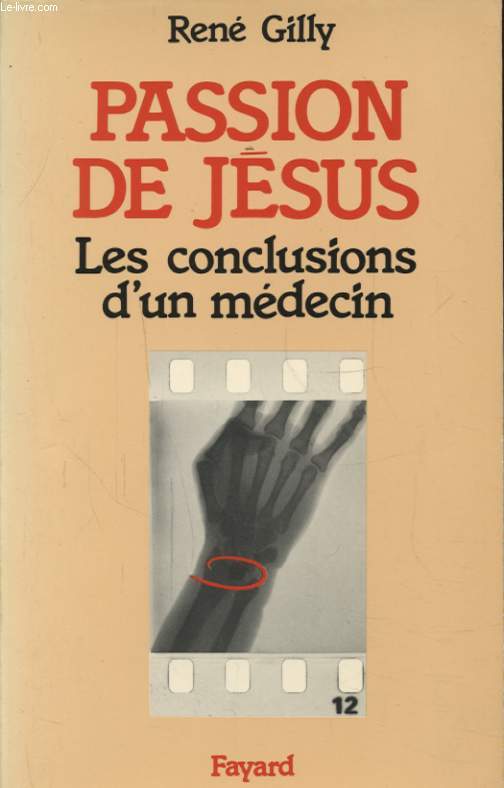 PASSION DE JESUS LES CONCLUSION D UN MEDECIN