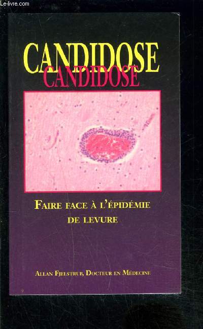 CANDIDOSE- FAIRE FACE A L EPIDEMIE DE LEVURE