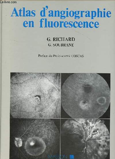 Atlas d'angiographie en fluorescence.
