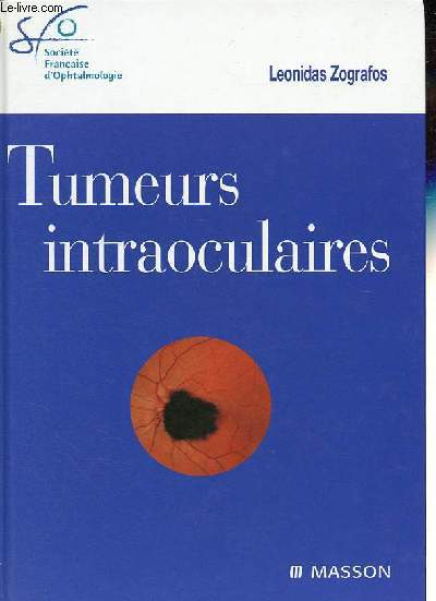 Tumeurs intraoculaires - Collection Socit franaise d'ophtalmologie.