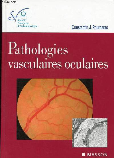 Pathologies vasculaires oculaires - Collection Socit franaise d'ophtalmologie.