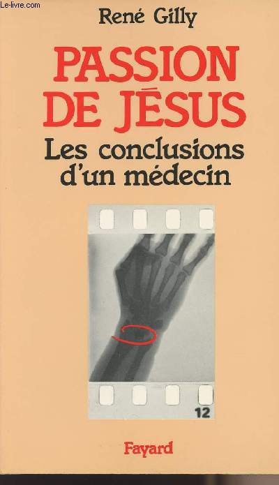 Passion de Jsus - Les conclusions d'un mdecin