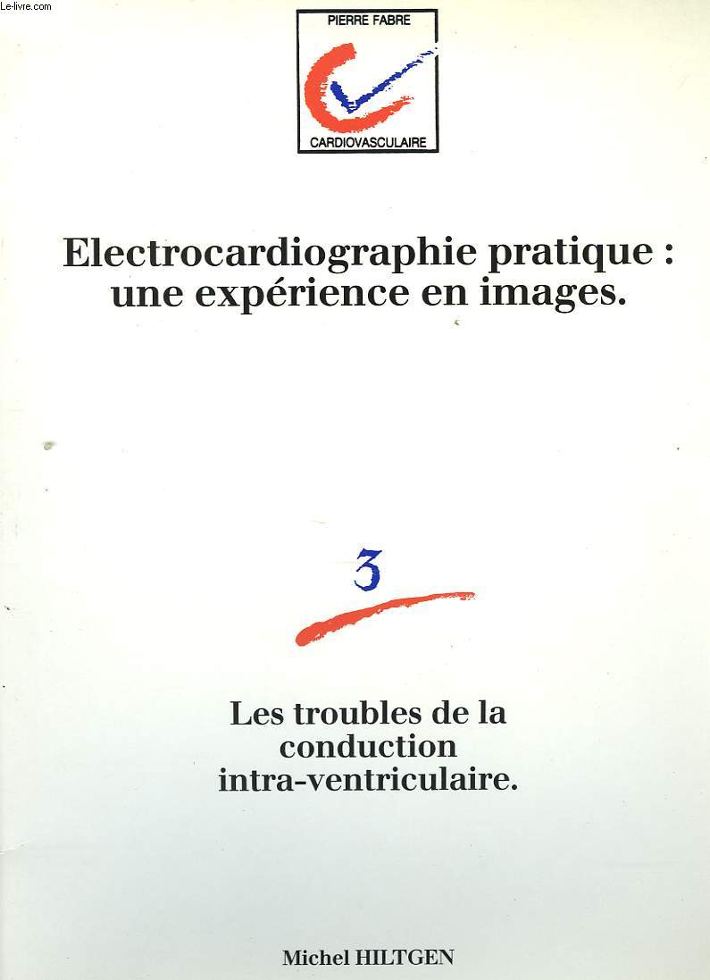 ELECTROCARDIOGRAPHIE PRATIQUE: UNE EXPERIENCE EN IMAGE. 3. Les troubles de la conduction intra-ventriculaire.