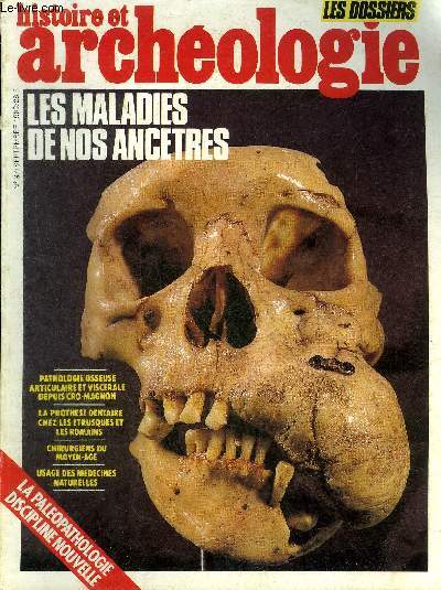 DOSSIERS DE L'ARCHEOLOGIE N 97 SEPTEMBRE 1985 - Palopathologie et histoire - la palopathologie au service de l'archologue et de l'historien - difficults et cueils en Palopathologie - la palodontologie tude des maladies des dents etc.