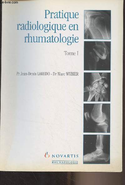 Pratique radiologique en rhumatologie - En 2 tomes