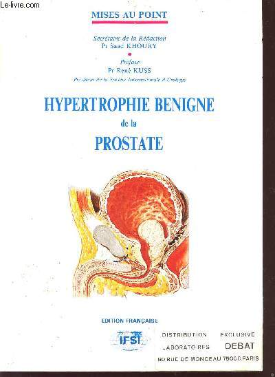 HYPERTROPHIE BENIGNE DE LA PROSTATE / COLLECTION MISE AU POINT.