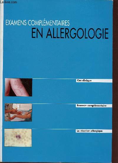 Examens complémentaires en allergologie - Cas clinique, examen complémentaire, la réaction allergique.