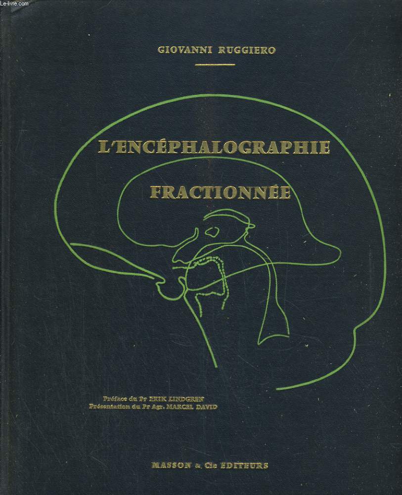 L'encephalographie fractionne.