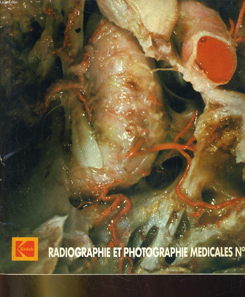Radiologie et photographie medicales n14