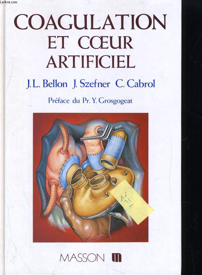 COAGULATION ET COEUR ARTIFICIEL. NOUVELLE APPROCHE DE CONTROLE ET DE TRAITEMENT