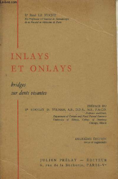 Inlays et Onlays : Bridges sur dents vivantes