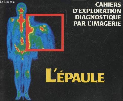 Cahiers d'exploration diagnostique par l'imagerie : L'paule