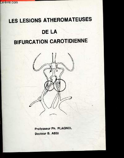 Les lesions atheromateuses de la bifurcation carotidienne - brochure - les carotides, angiographie, tomodensitometrie, traitements, examens ultra sonores...