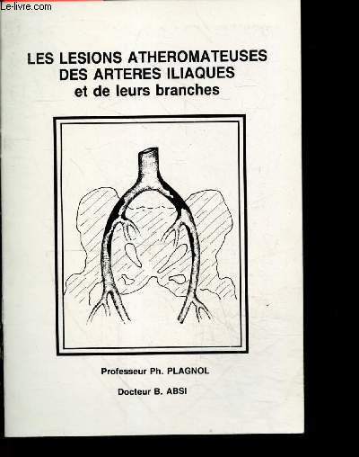 Les lesions atheromateuses des arteres iliaques et de leurs branches - methodes diagnostiques : clinique interrogatoire signes physiques, paracliniques, doppler, pressions au repos et a l'effort, plethysmographie, angiographie, traitements...