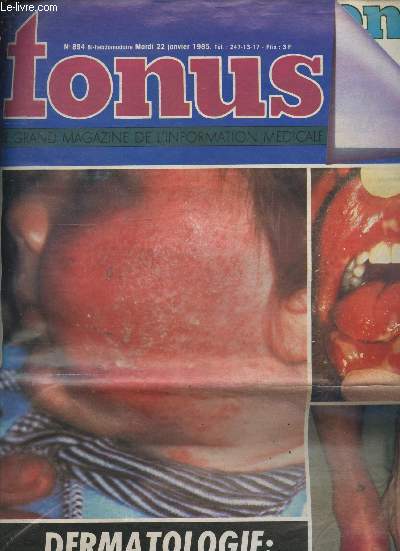 Tonus n894, mardi 22 janvier 1985- magazine de l'information medicale- dermatologie: l'urgence a fleur de peau- la viscochirurgie: une troisieme main pour le chirurgien de l'oeil, des plasmides et des hommes: pour un peu d'adn de plus, dietetique des...