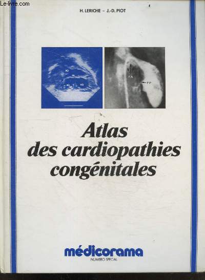 Atlas des cardiopathies congenitales - 1987 numero special - reserve au corps medical- tetralogie de fallot, atresie pulmonaire a septum ouvert, malformations des valves auriculo ventriculaires, agenesie des valves pulmonaires avec communication inter...
