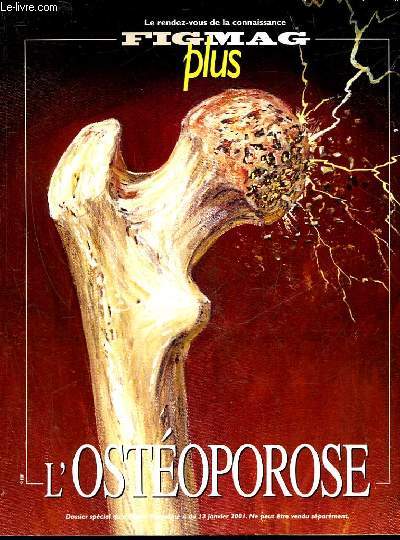 FIGMAG PLUS - L'OSTEOPOROSE