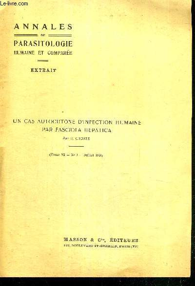 UN CAS AUTOCHTONE D'INFECTION HUMAINE PAR FASCIOLA HEPATICA - ANNALES DE PARASITOLOGIE HUMAINE ET COMPAREE - EXTRAIT - TOME VI - N3 - JUILLET 1928