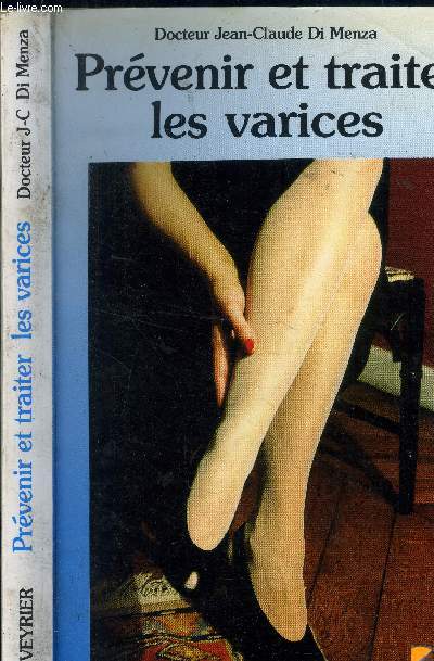 Prvenir et traiter les varices