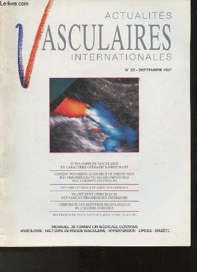 Actualits vasculaires internationales- N 53- Septembre 1997-Sommaire: Echo-Doppler vasculaire et caractre oprateur-dpendant- Moyens non mdicamenteux de prvention des thromboses veineuses profondes des membres infrieurs- Instabilit de la plaque d'