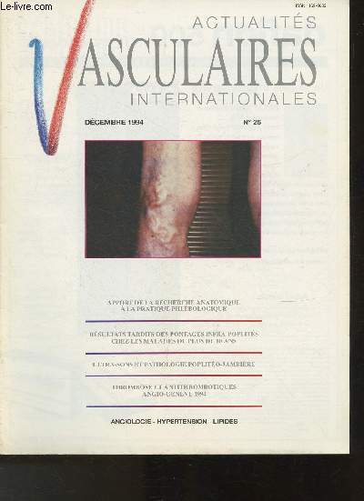 Actualits vasculaires internationales- N26 - Dcembre 1994-Sommaire: Apport de la recherche anatomique  la pratique phlbologique- Rsultats tardifs das pontages infra-poplits ches les malades de plus de 80 ans- Ultra-sons et pathologie poplito-jambi