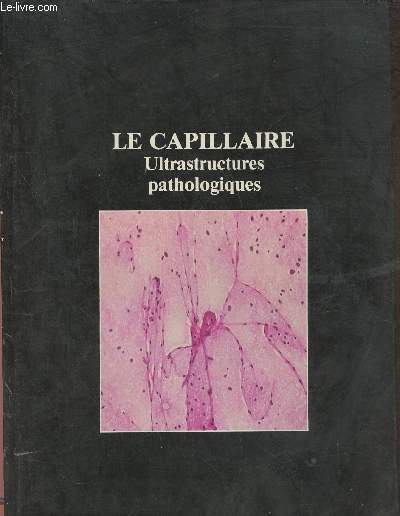 Le capillaire- Ultrastructures pathologiques