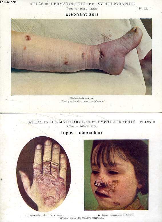 ATLAS DE DERMATOLOGIE ET DE SYPHILIGRAPHIE