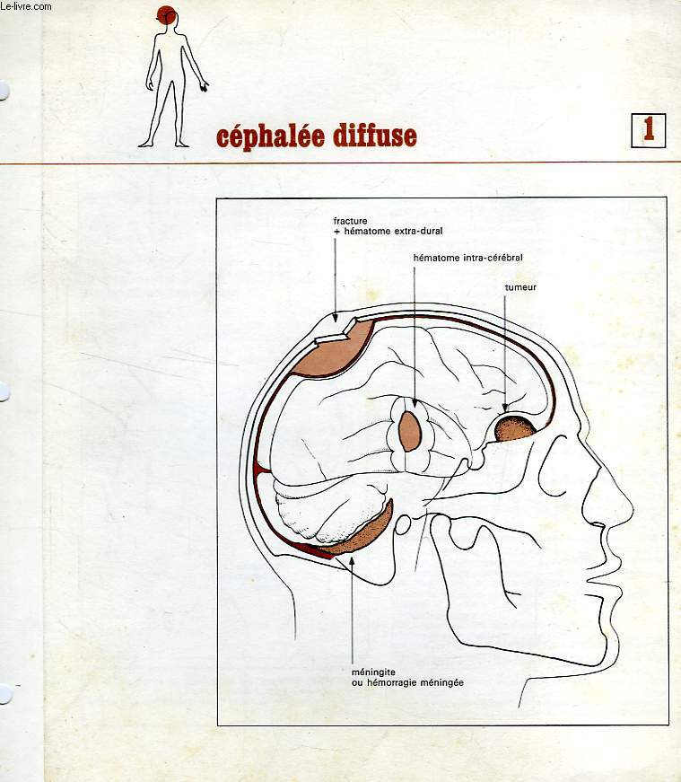 FICHES ANATOMIE ET DOULEURS (SANS TITRE)