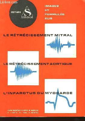 Le Rtrcissement Mitral - Le Rtrcissement Aortique - L'Infarctus du Myocarde.