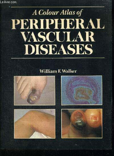 A COLOUR ATLAS OF PERIPHERAL VASCULAR DISEASES