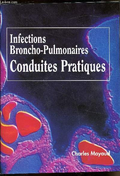Infections Broncho-Pulmonaires - Conduites pratiques