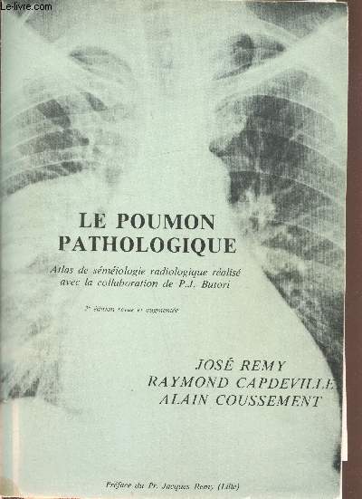 Le poumon pathologique - Atlas de semiologie radiologique -